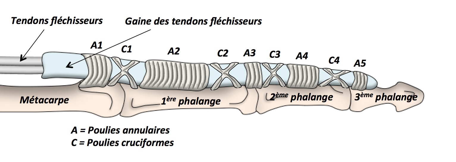 Doigts à Ressaut - Clinique Ostéo Articulaire Des Cèdres - Grenoble